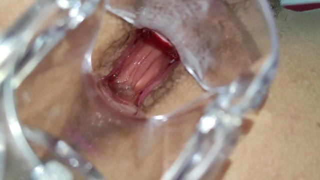 anal orgasms excellent view of my anal hole with speculum